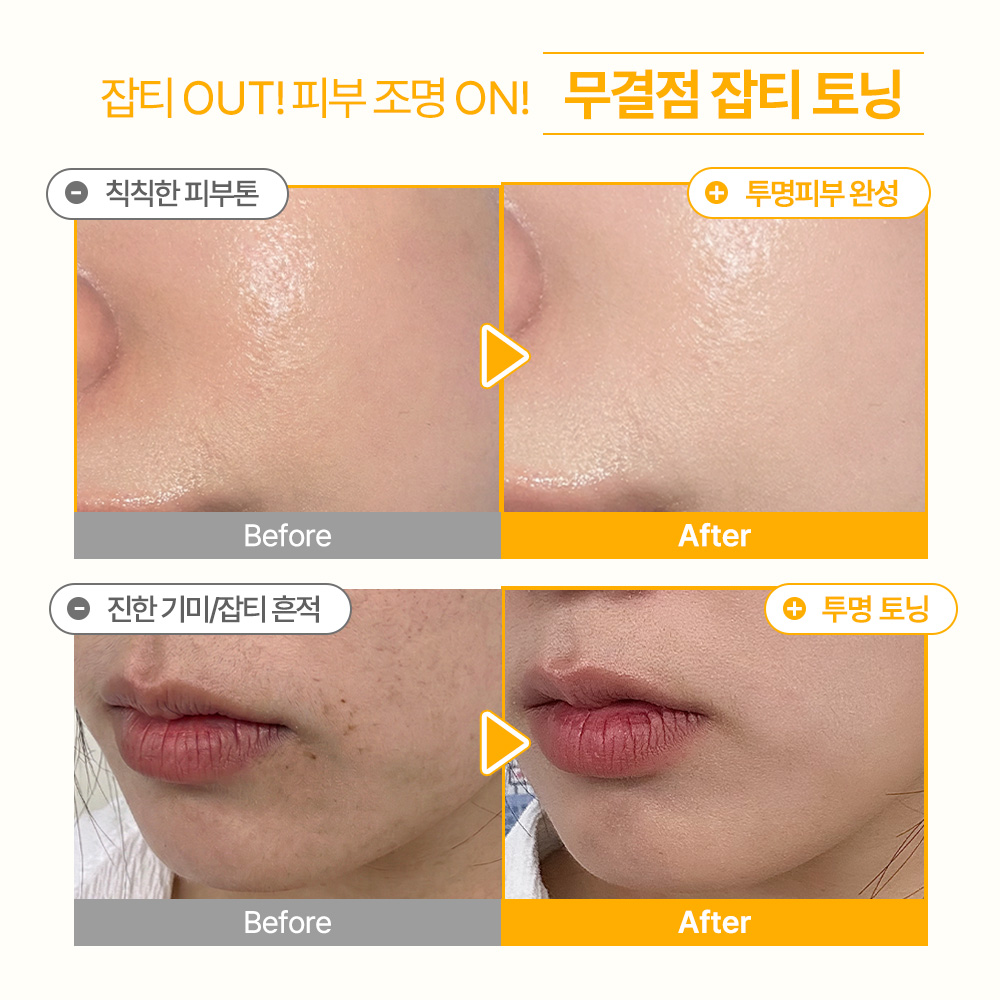 비타C 나이아신아마이드 5% 버블샷 브라이트닝/미백 앰플 1개입, 1개 - 상세 이미지 4