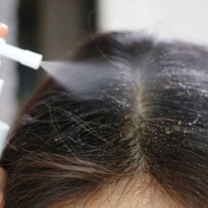 스쿠알란 두피 케어 쿨링 스프레이 헤어 토닉 200ml 솔직 후기 | 피부 타입별 분석 - 상품 이미지 4