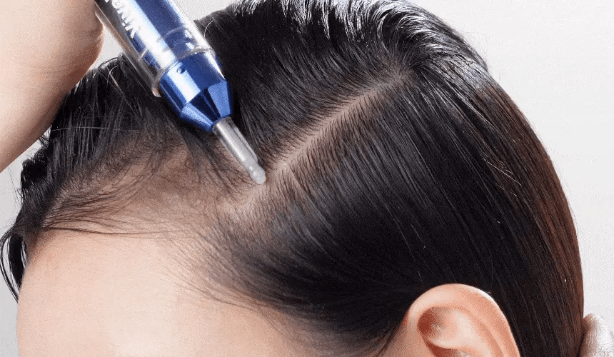 VIVELAB Scalp Spioxyl React Shot 400 - description 13