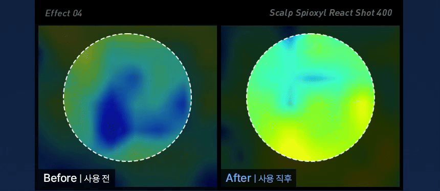 VIVELAB Scalp Spioxyl React Shot 400 - description 18