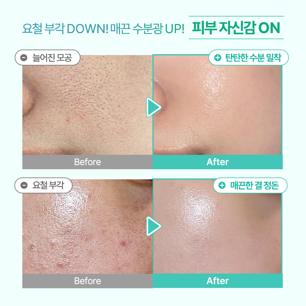 [1+1] 오미티드 민감성 피부 진정 LHA 결광 수분 모공 세럼 50ml, 2개 이미지 4
