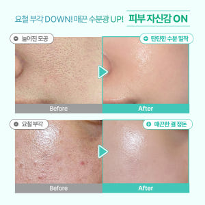[1+1] 오미티드 민감성 피부 진정 LHA 결광 수분 모공 세럼 50m... 솔직 후기 | 피부 타입별 분석 - 상품 이미지 4