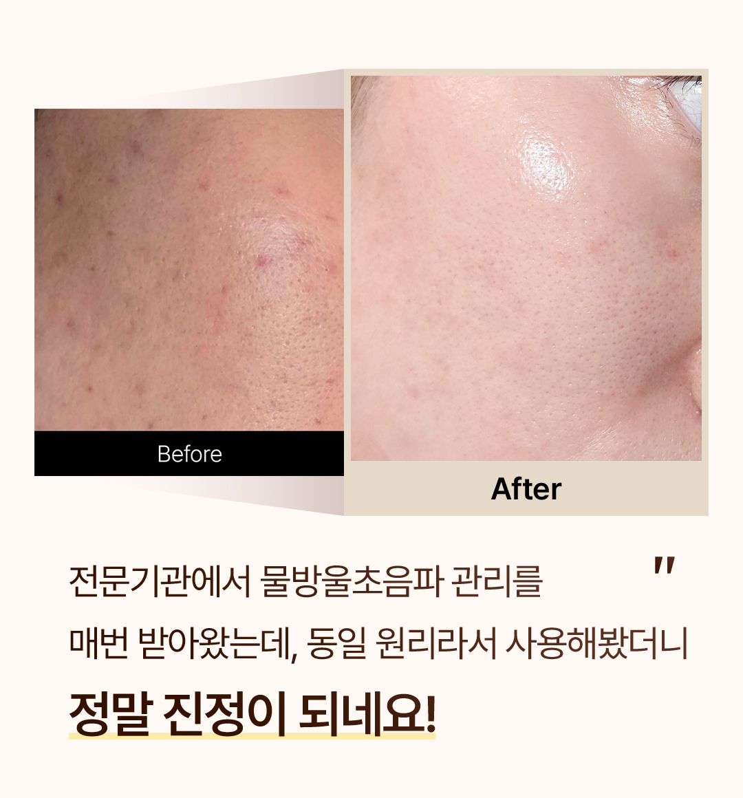 ONGREDIENTS Ceradeep Glow Wave Device & Boosting Serum Set - description 12