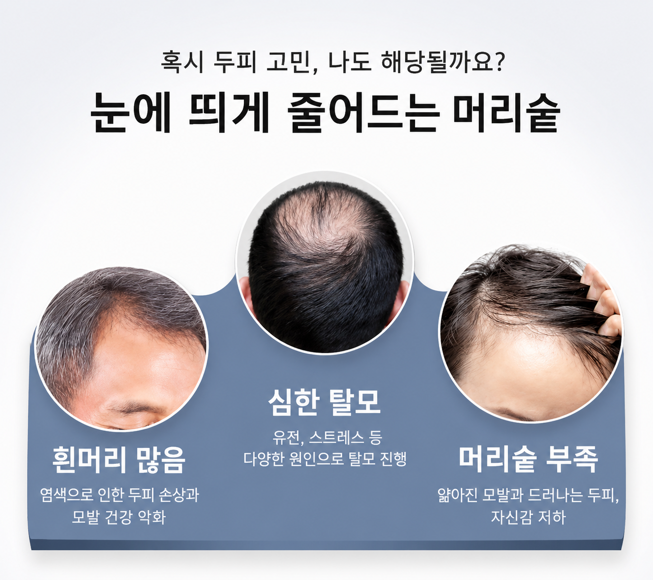 중년 남성 전신가발 중장년 항암가발 자연스러운 짧은머리 인모 100% - 상세 이미지 4
