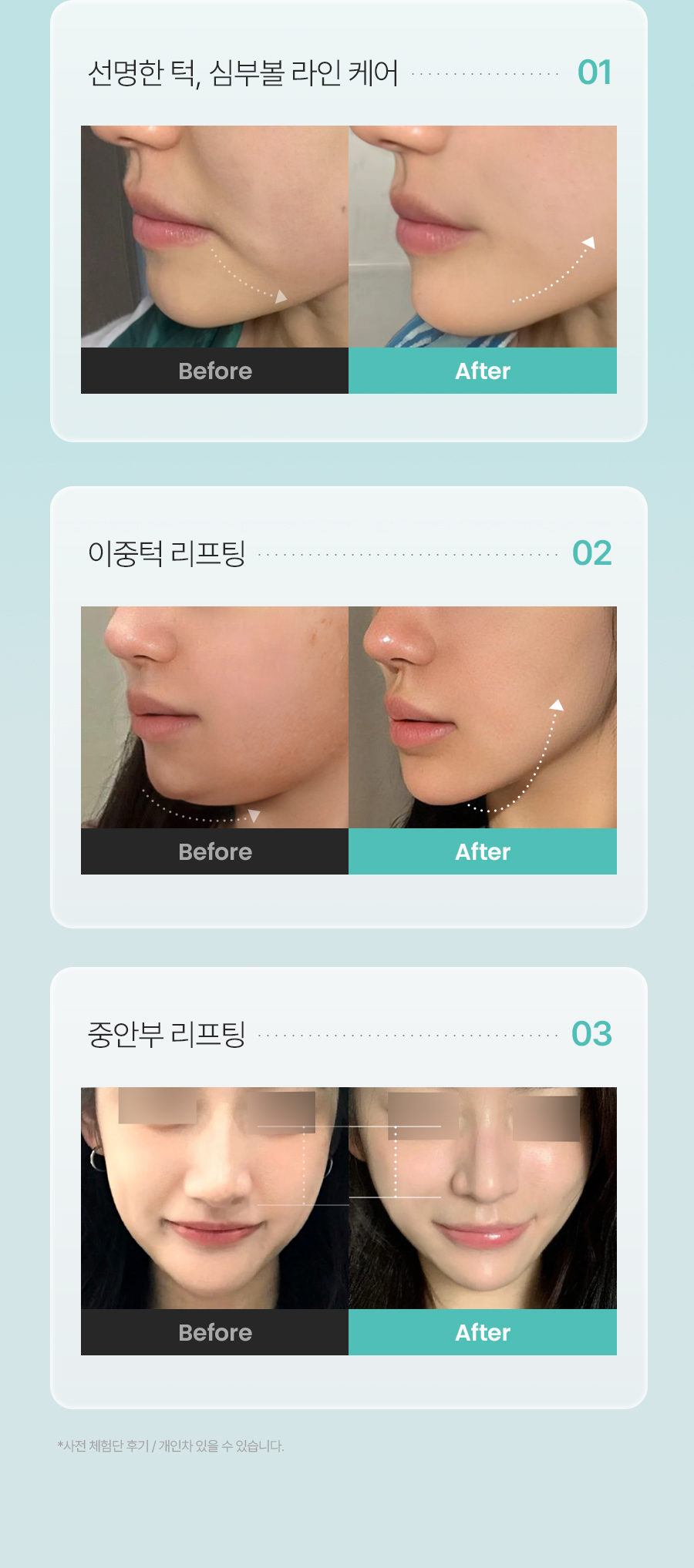 CHARDE Bubble Jection Serum & Lifthera Gel Mask Set - details 45