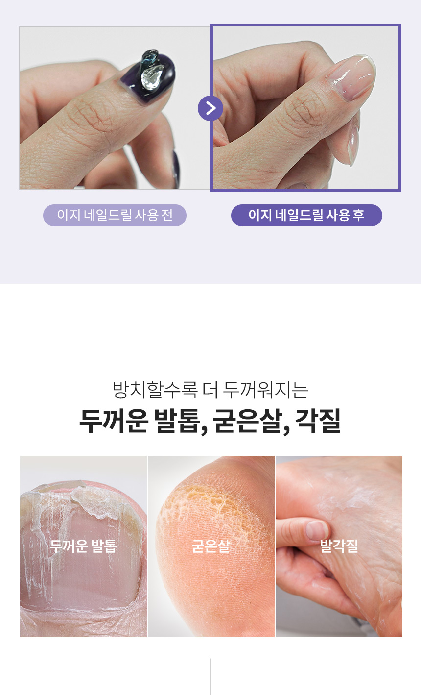 오아 이지 네일 드릴 무선 큐티클 손톱 젤 셀프 제거 전동 쏙오프 발톱 케어 정리기 상세 이미지 7